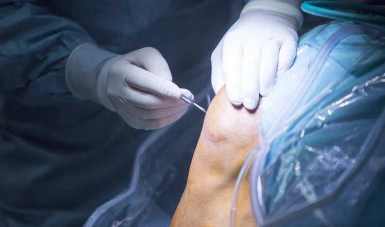CSOG-Meniscus-Tear-Surgery