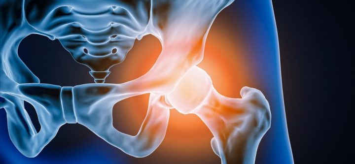 Hip-Replacement-Surgery-Dubai Hip-Replacement-Surgery-Dubai