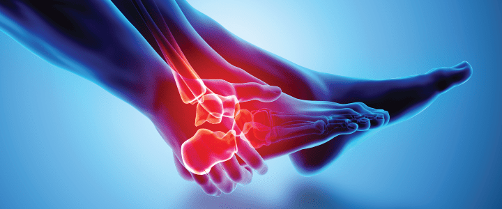 MC-2432 Images for CPT 191_870x300_Ortho MC-2432 Images for CPT 191_870x300_Ortho