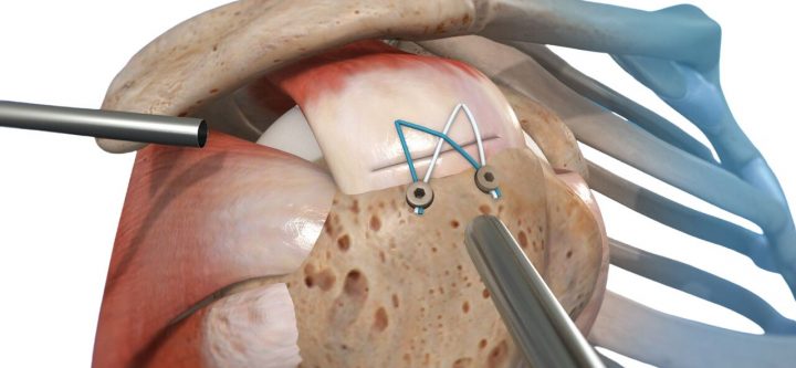 xr:d:DAFxCZDdOYQ:4,j:3787933049706706084,t:23101210 xr:d:DAFxCZDdOYQ:4,j:3787933049706706084,t:23101210