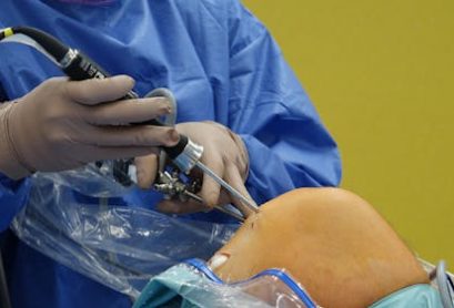 free-photo-of-surgeon-performing-knee-arthroscopy-procedure