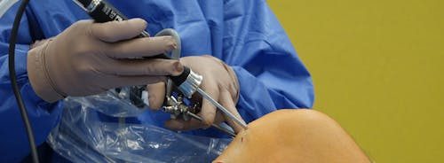 free-photo-of-surgeon-performing-knee-arthroscopy-procedure