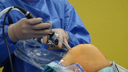 free-photo-of-surgeon-performing-knee-arthroscopy-procedure free-photo-of-surgeon-performing-knee-arthroscopy-procedure