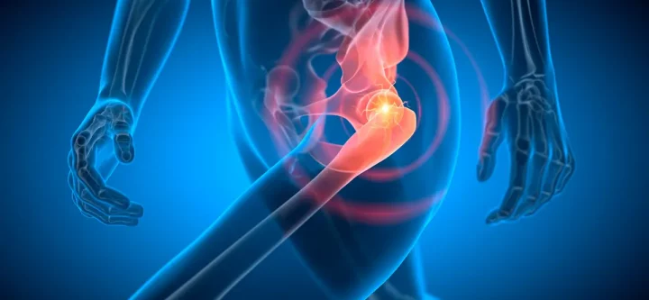 posterior-approach-og-img posterior-approach-og-img