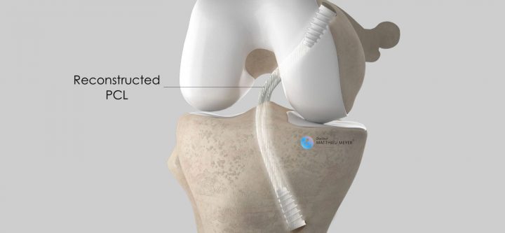 7-pcl-final 7-pcl-final