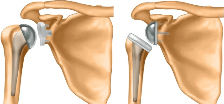 96c06844e824d0df4b7ef2118562809f