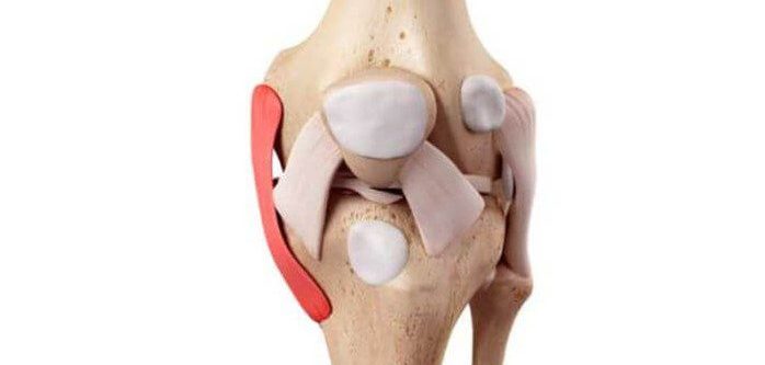 MPFL-Anatomy MPFL-Anatomy