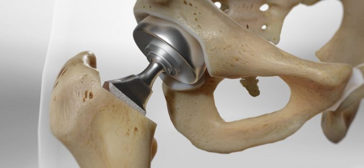 hiphemiunipolar_1280