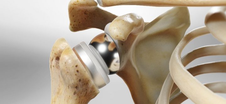 reversetotalsho_1280